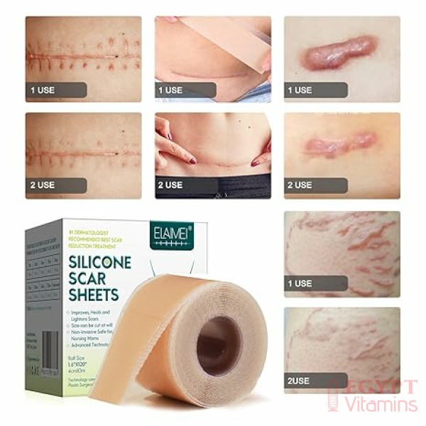 ⁦Silicone Scar Sheets (1.6” x 120” Roll-3M), Silicone Scar Tape Roll, Scar Silicone Strips, Reusable, Professional Scar Removal Sheets for C-Section, Surgery, Burn, Keloid, Acne et⁩ - الصورة ⁦4⁩