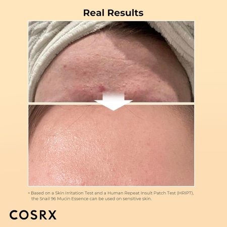 COSRX, Snail Mucin 96% Power Essence, Results