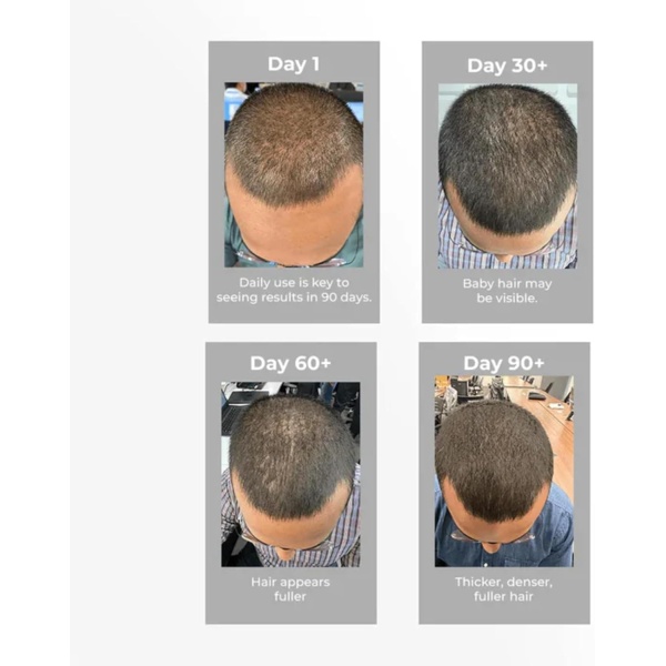 Pilgrim Hair Growth Serum | Redensyl & Anagain | Stops Hair Loss - Image 9