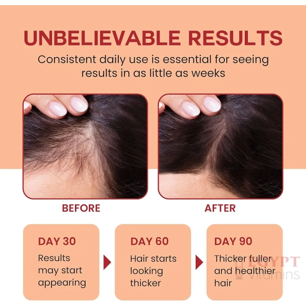 Raw Batana Oil for Hair Growth - 100% Pure, Organic 4oz Batana from Honduras for Thick and Strong Natural Hair - Dr. Sebi Unrefined Cold Pressed Cosmetic Scalp Mask for Men & Women - Image 4