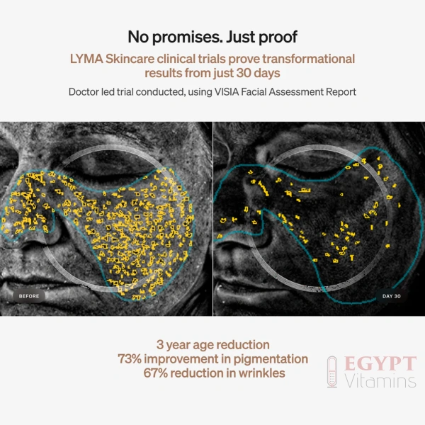 LYMA Skincare | Epigenetic Anti-Aging Serum & Cream Starter Kit - Image 4
