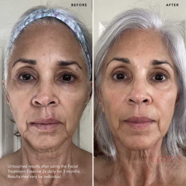⁦اسنس المعالجة للوجه من SK-II | ماء المعجزة الشهير بتركيبة بيترا⁩ - الصورة ⁦2⁩